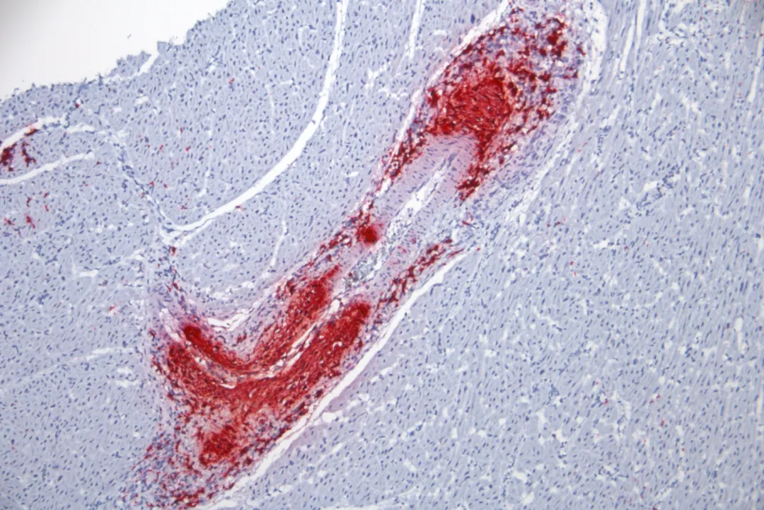 from clipboard from clipboard